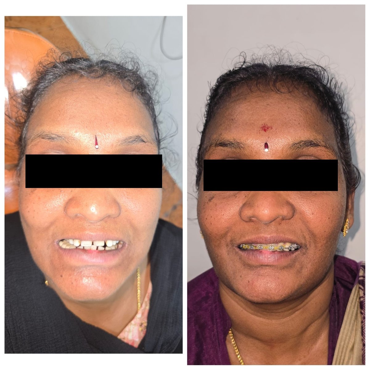 Before and after treatment